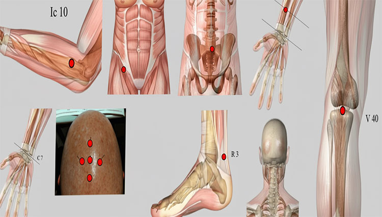 Conditions and Health Issues Treatable with Acupuncture
